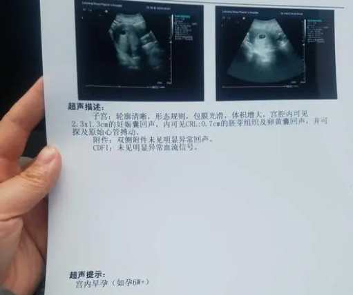 2023杭州供卵二代试管婴儿包生男孩的医院排名附供卵费用清单